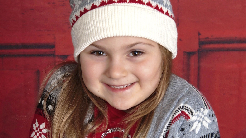 Abigail after receiving titanium rib