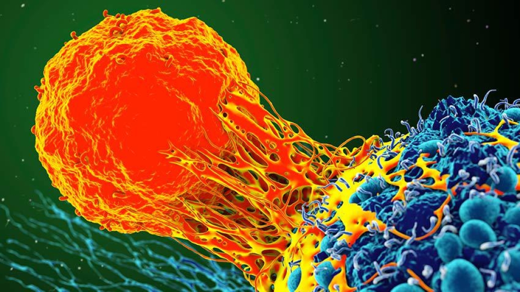 cancer cell in orange under microscope