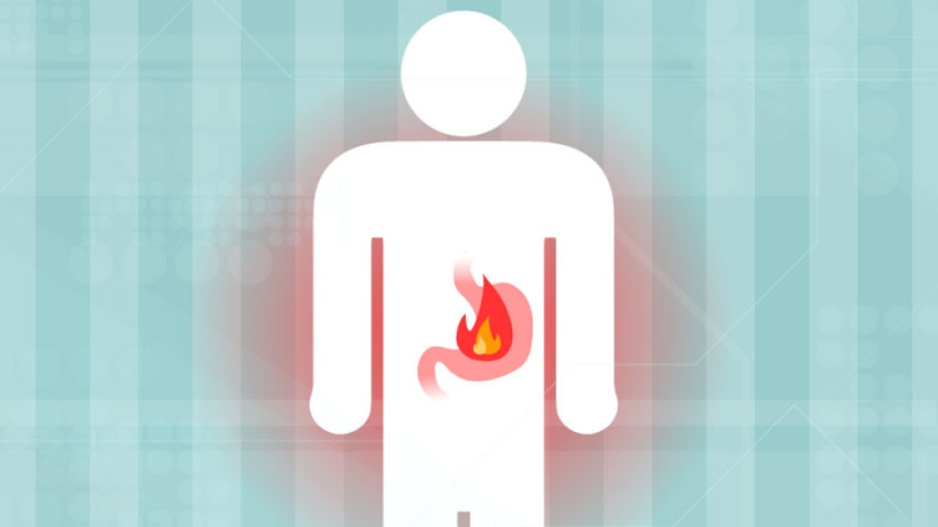 Heartburn image