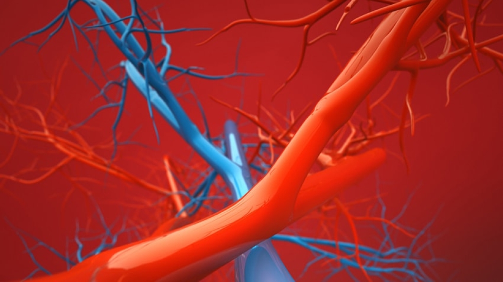 The simulated blood vessels of a jugular vein aneurysm