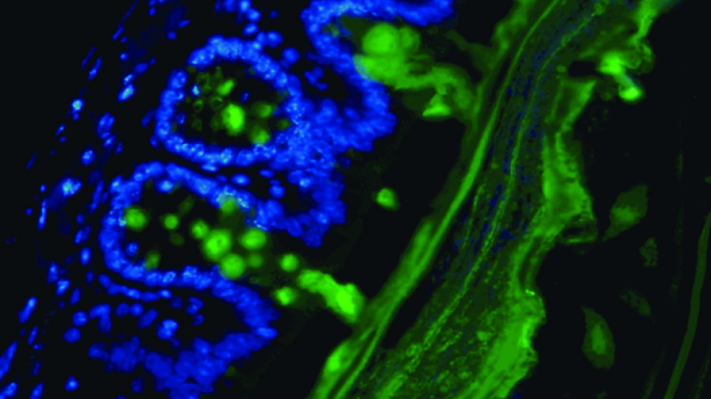 Microscopic image of gut bacteria eating the colon lining