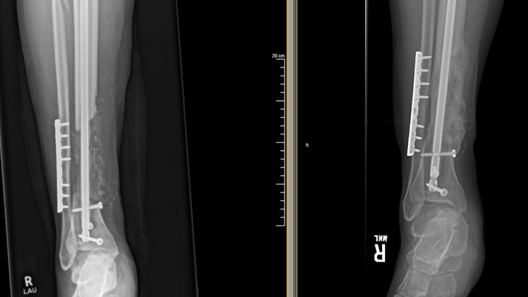 x-ray image
