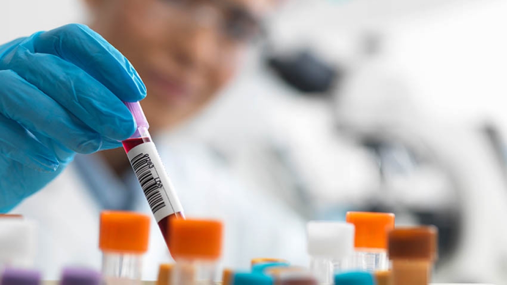 female testing blood sample