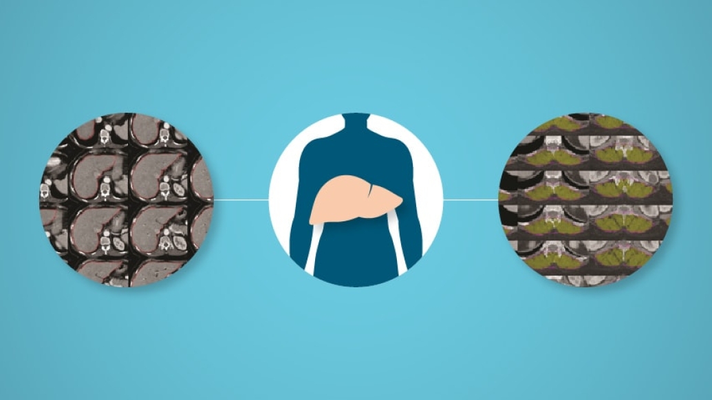 Image of liver scans