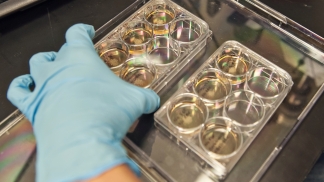 Photo of a gloved hand touching petri dishes containing stem cells
