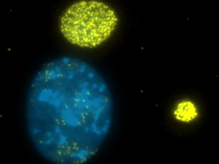 Mouse model of human colorectal cancer