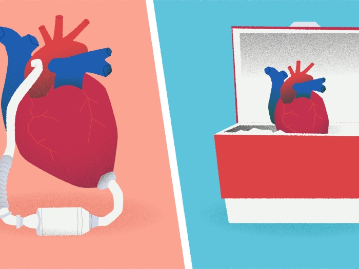 VAD heart device cooler red and teal