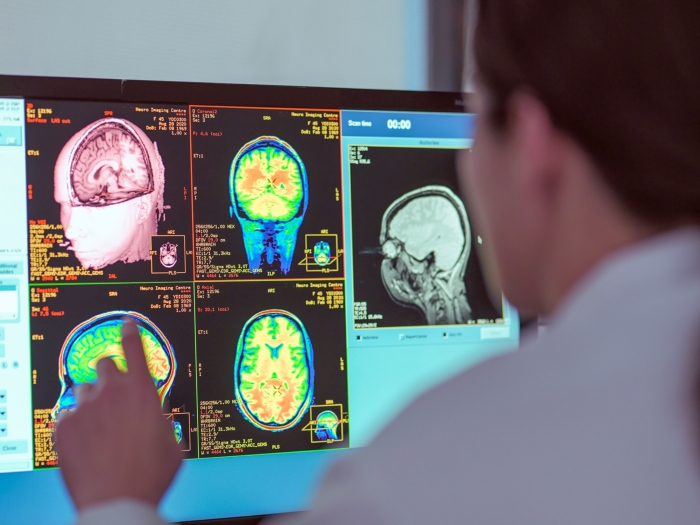 images on computer of scans