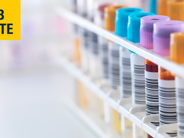 blood vials colorful lab notes