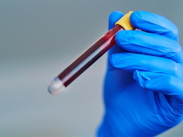 blue glove holding blood vial