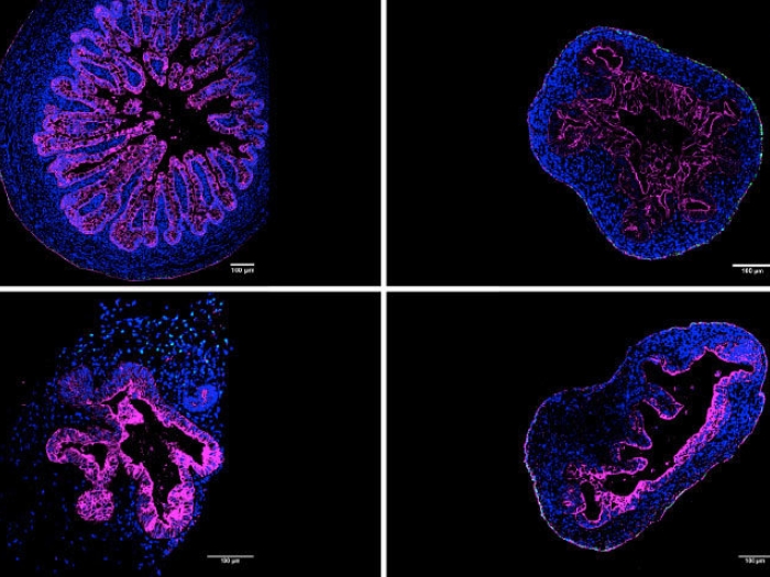 blue purple microscopic slide intestine