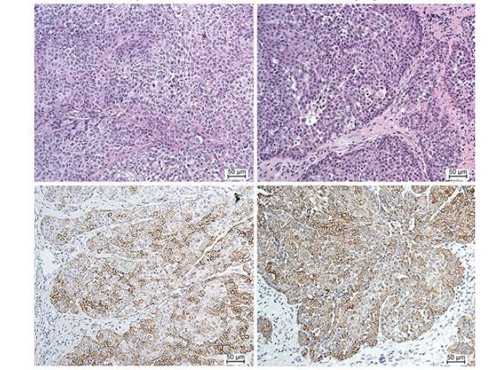 cell slides under microscope 