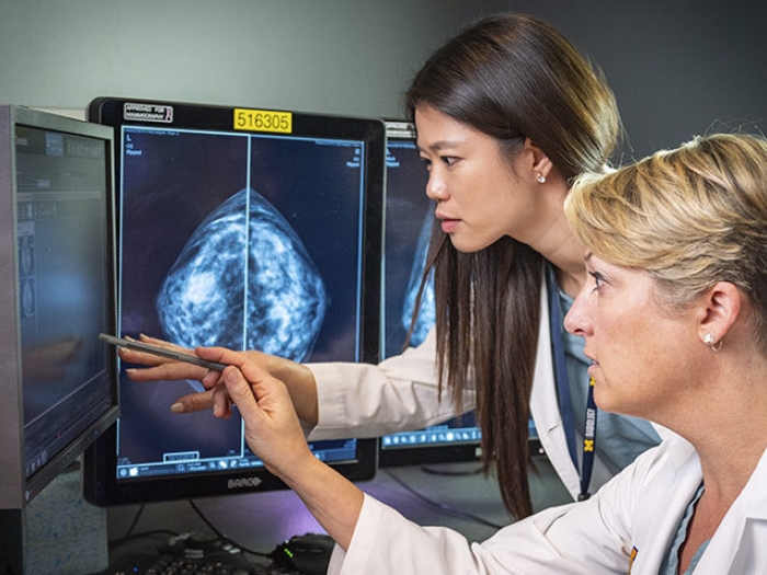 doctors pointing to computer scan of mammogram on the computer