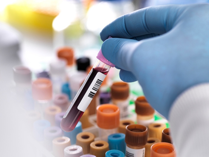 gloved hand holding blood vial