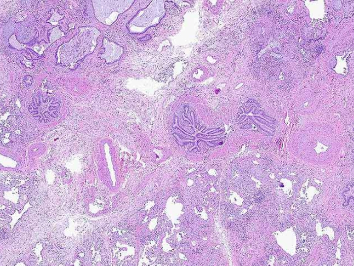 pink purple cellular microscopic slide