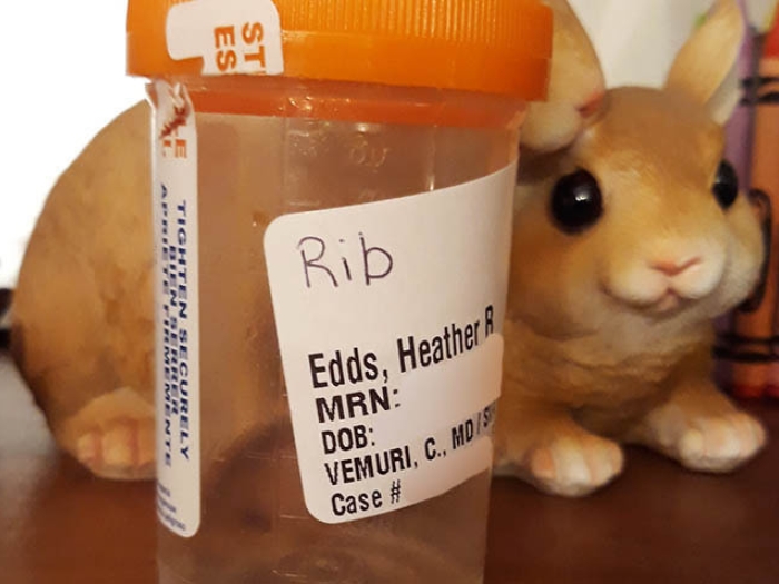 Rib of patient in container