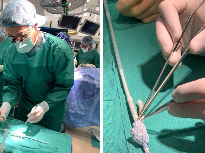 Surgeon in gown with surgical tools in hand working on tube. Nurses in background assisting.
