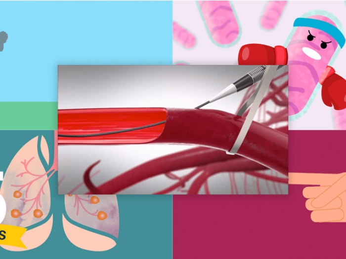 collage of top visuals: baseball player throwing, pink cell dressed up as boxer, lungs with cancer treatment in them, finger prick - with 5 year anniversary sticker on bottom left