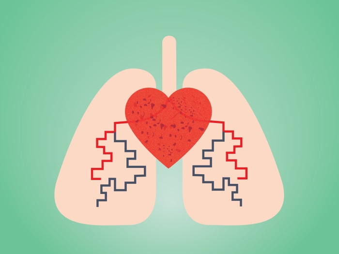 Graphic of a heart and lungs with pulmonary hypertension
