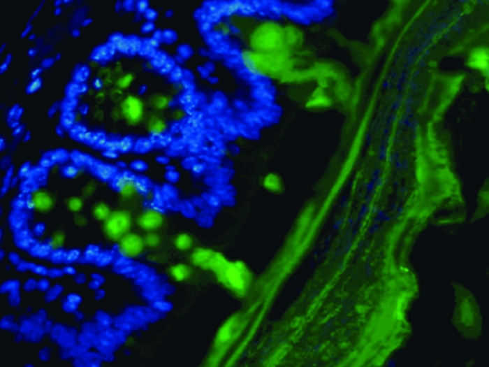 Microscopic image of gut bacteria eating the colon lining