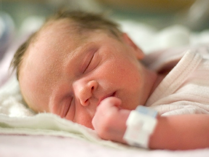 Premature baby diagnosed with retinopathy of prematurity