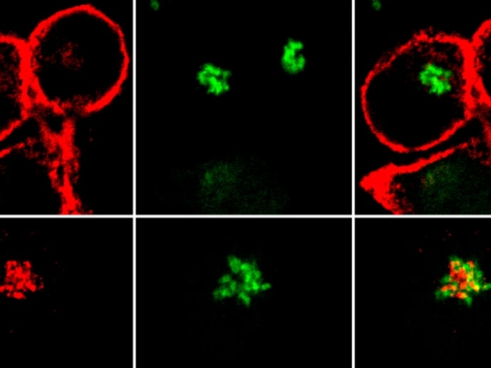 Nef proteins stopping healthy proteins form alerting the immune system of HIV