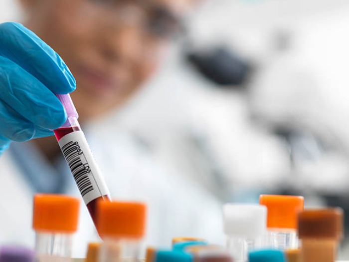 female testing blood sample