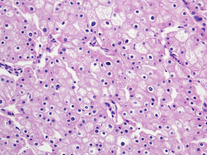 Kidney cells strained