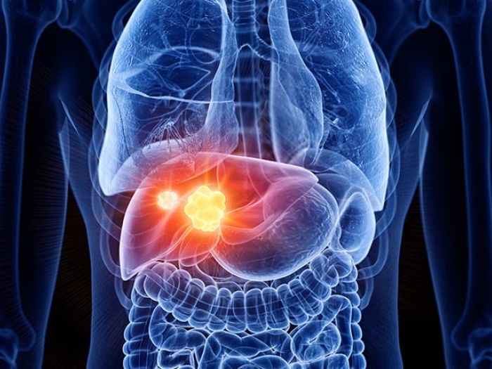 liver cancer red and orange in a blue body virtual drawing