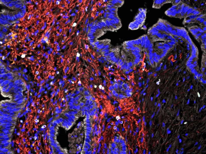 purple black red cell image close up